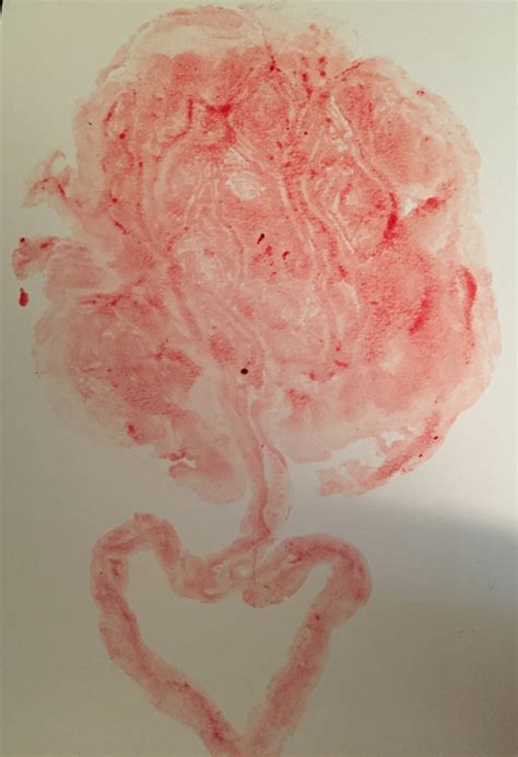 Your Afterbirth and You — Beautiful Births & Beyond