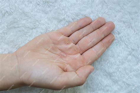 Premium Photo | Exercise gives me calluses on my palms hands blistered from the hard work of ...