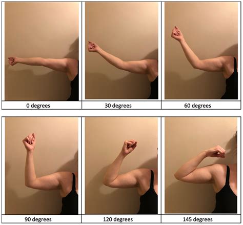 Patients can accurately self-report their elbow range of motion following surgery for trauma ...