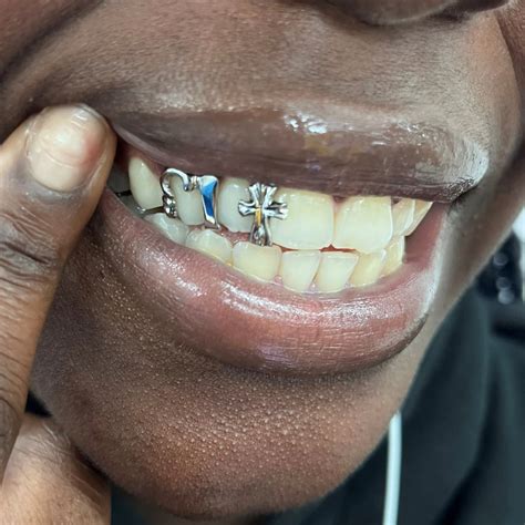 Custom gold strip and gothic cross design | Grillz, Teeth jewelry, Grills teeth