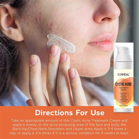 Cystic Hormonal and Severe Acne Treatment Cream - Anti Acne Ingredients, USA Designed, Japan ...