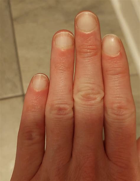 Large Half Moons On Fingernails