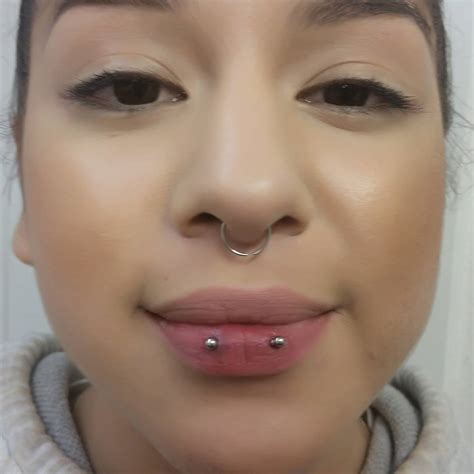Horizontal Lip Piercing Scar
