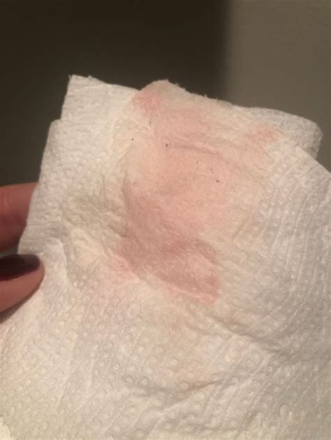 Light Pink Discharge During Ovulation