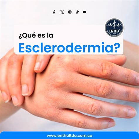 ¿Qué es la Esclerodermia? - ENTHA