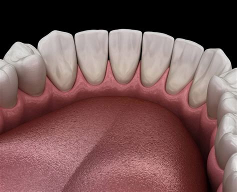 What is Torus Mandibularis? (9 Causes and Detailed Symptoms)