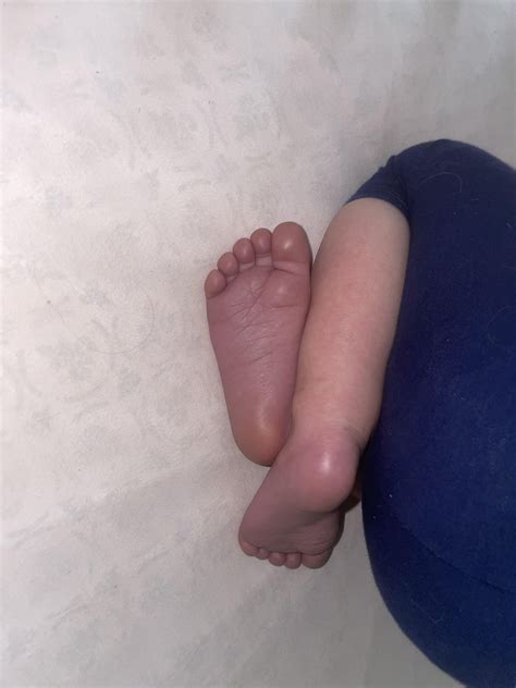 Toddler feet turning purple?! : r/firsttimemom