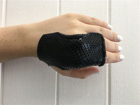 Hand Based Radial Gutter Splint Pattern at Johnny Duffy blog