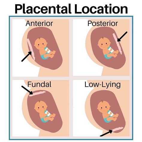 Meaning Of Placenta Posterior