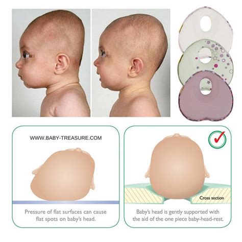 How To Shape A Newborn Baby Head at Ava Lazarev blog