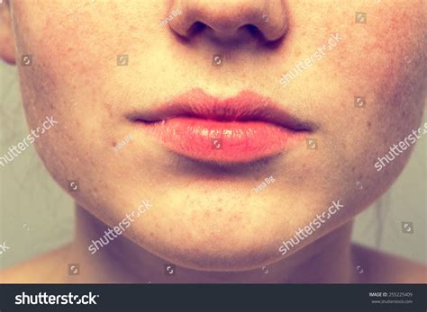 Freckles On The Lips