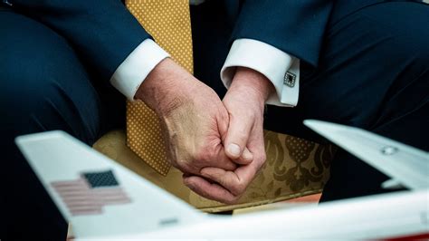 Trump Diagnosed With Chronic Venous Insufficiency After Leg Swelling ...