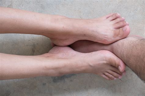 Varicose Veins Feet Varicose Veins In The Feet And Ankles