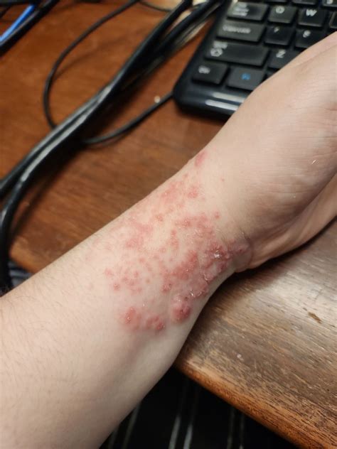 What is this? : r/DermatologyQuestions