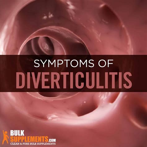 Diverticulitis flare symptoms. The Definitive Guide to Diverticulitis Flare-Ups: Symptoms, Risks ...