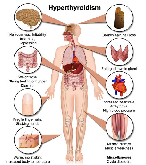 Signs Of Common Hormonal Imbalances In Men