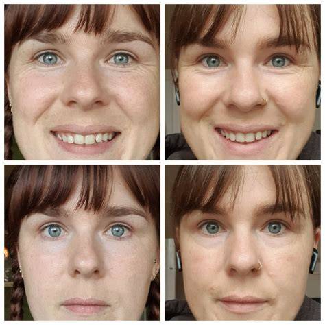 Tret 0.05 6 months in, for anti ageing. My fella can't see any difference but I think I can ...