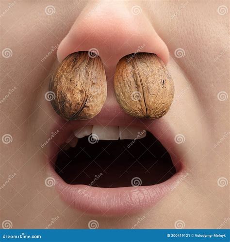 Close Up Human Nose with Allergen Causes a Runny Nose and Sneezing ...