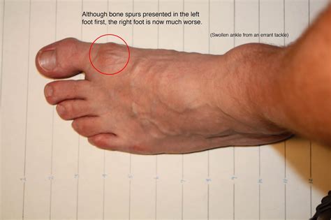 What Does Spurs Look Like at Lillie Authement blog