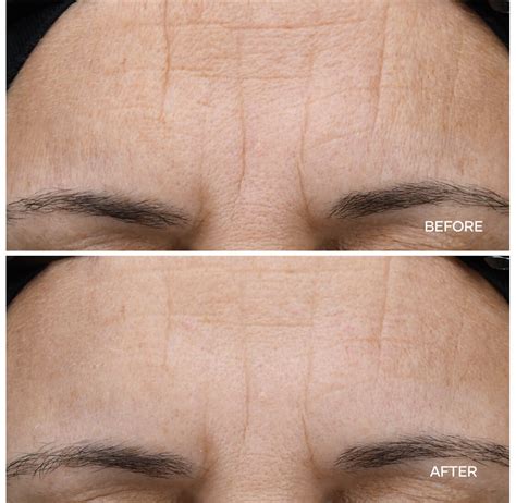 Best Anti-Wrinkle Under-Eye Roller with Caffeine & Peptides Serum | Shaklee