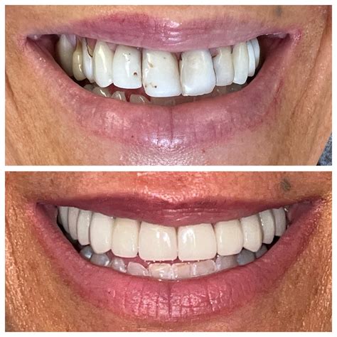 Dental Success Stories | Omni Dental Shadyside