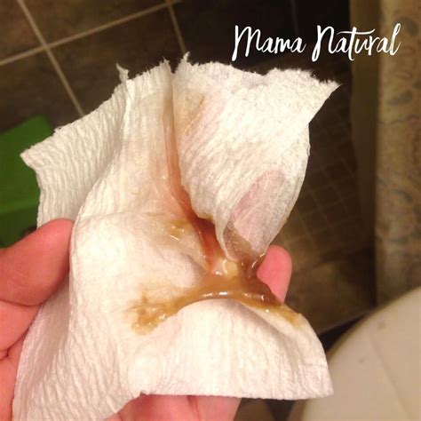 Mucus Plug Before And After Baby Dropping Diagram Mucous Plu