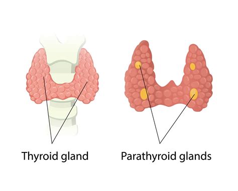 Weight Gain And Parathyroid Disease Parathyroid Surgery In Boulder, CO