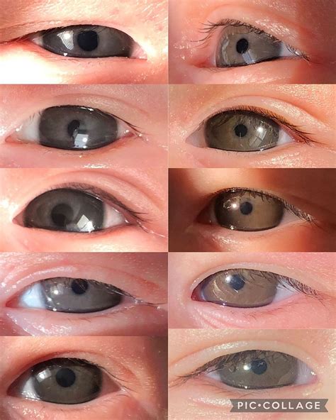 What color will her eyes be?? Eye color progression | BabyCenter