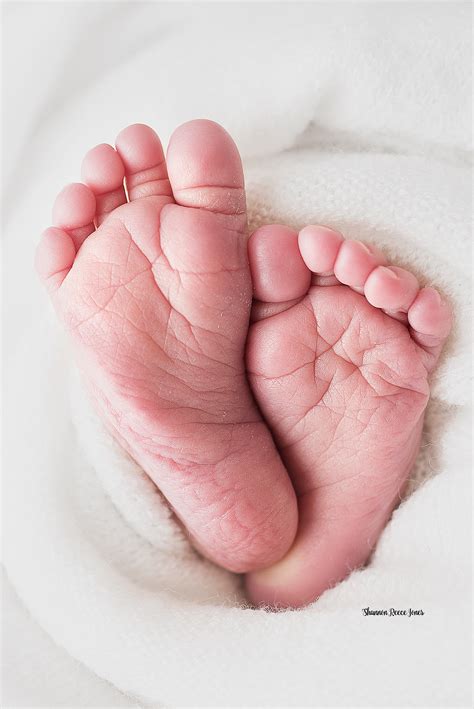 Baby Born With Blue Feet And Hands at Lachlan Macadie blog