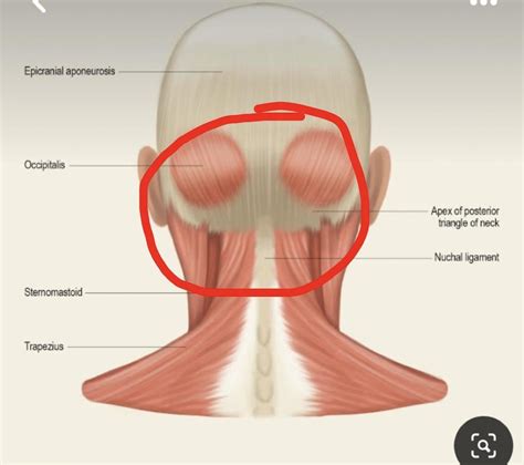 Experiencing what seems like occipital headaches, neck pain where my spine and skull meet, and ...