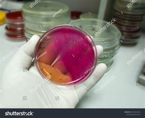 42 E Coli Lactose Test Images, Stock Photos & Vectors | Shutterstock