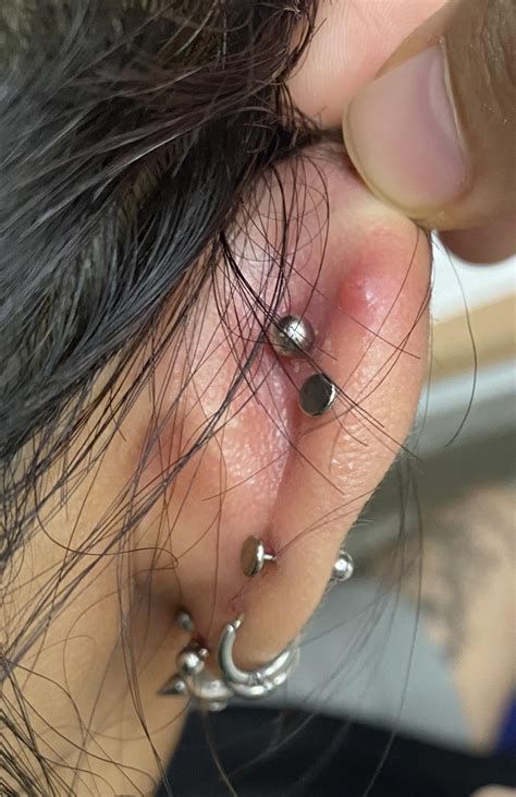 keloid or irritation bump? : r/piercing