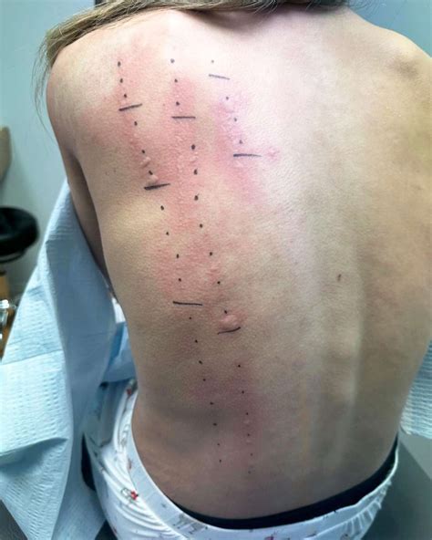 Mikayla Matthews Shares Struggles with Her Chronic Illness