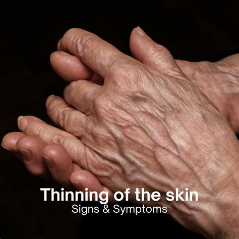 Thinning of the Skin: Causes, Symptoms, and Treatment