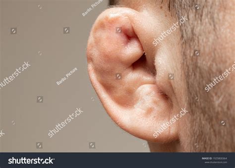 Ear Cartilage Cuts | External Ear Lacerations – WITDX