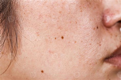 Pin Dots On Face at Diana Massey blog