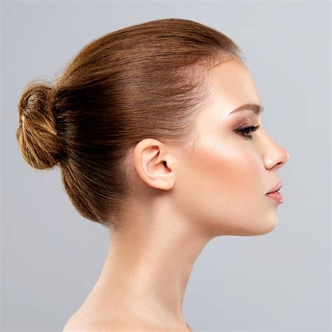 Dermal Fillers | Face Ltd