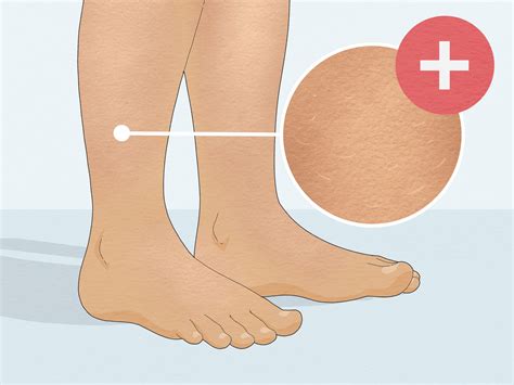 How to Heal Dry Skin on Legs: Quick & Easy Tips