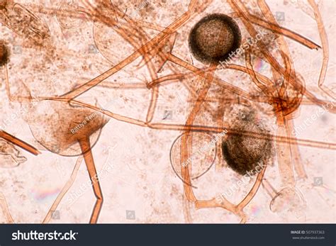 Rhizopus Under Compound Microscope