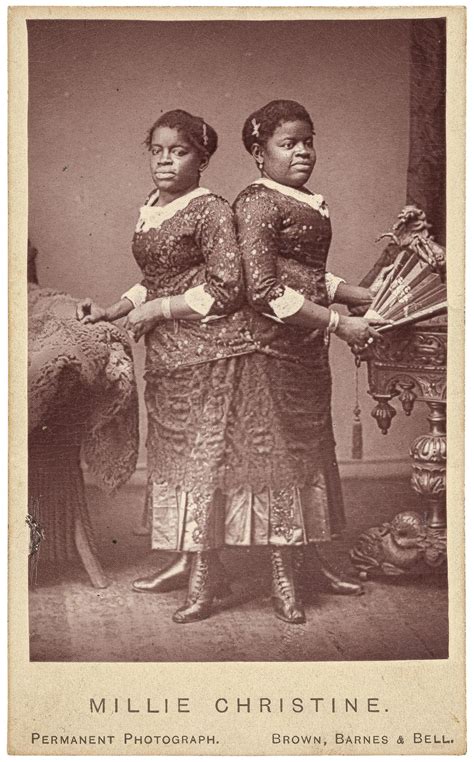 [Photograph of Conjoined Twins]: Millie and Christine by (McKOY, Millie ...