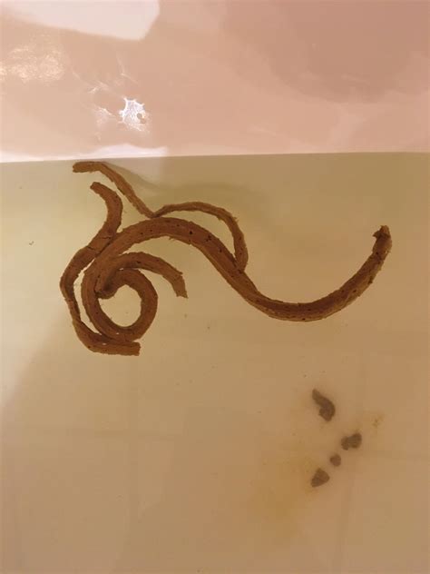 Long Skinny Thing In Poop at Roy Bush blog