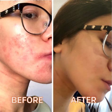 Why You Should Be Using Beef Tallow in Your Skin Care Routine – FATCO Skincare Products