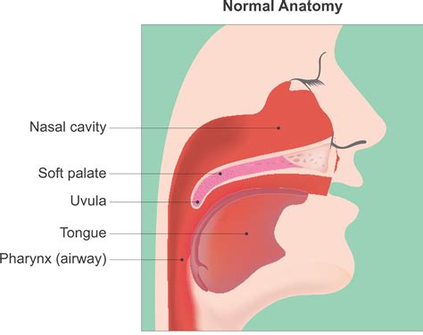 Sleep Apnea Treatment in Mission Viejo CA | Dr. Gannon Lee