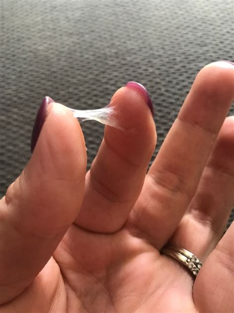 thick clear jelly like discharge - Captions Domestic