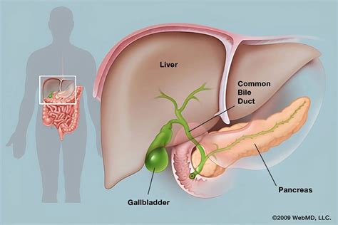 Gall Bladder Pain: Causes, Symptoms, Treatment