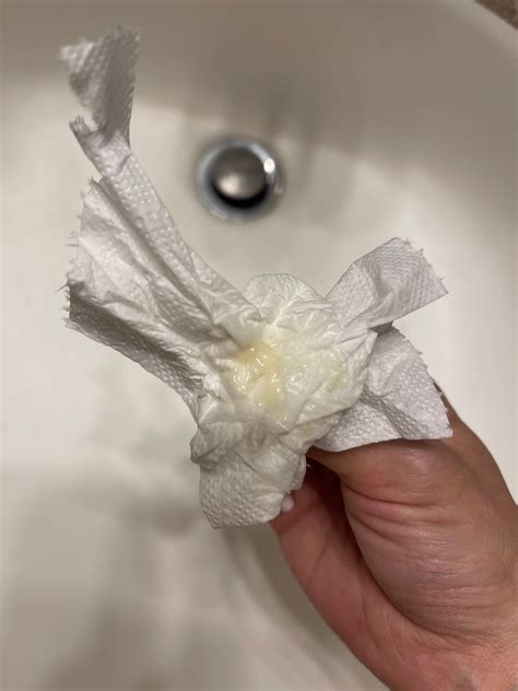 Why Is My Discharge Yellowish And Sticky at Hayden Champ blog