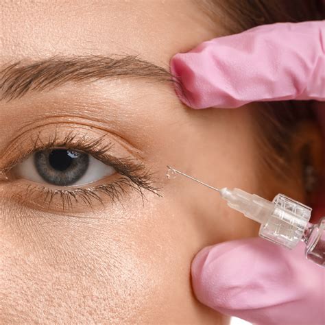 Dermal Fillers Help with Under-Eye Hollows? | Expert Guide