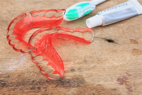 Everything About Wearing A Retainer After Braces | Jenson Dental