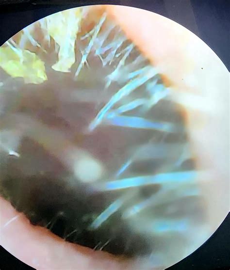 I can't stand having dirty ears with skin ribbons. : r/earwax