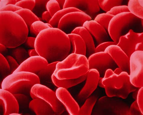 Calculate Osmotic Pressure Example Problem